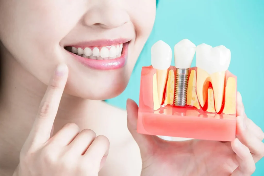 The-Top-4-Benefits-of-Dental-Implants